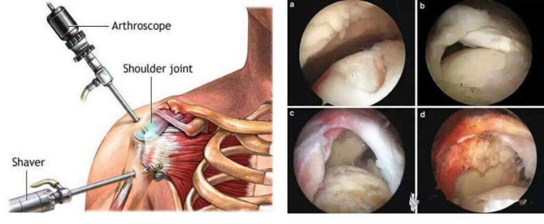 赶走疼痛，一身轻松！腰背痛，太原市中心医院疼痛科有妙招