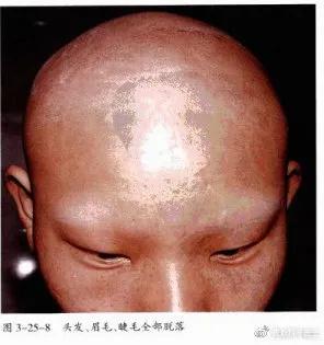 自我剖析问题原因和整改措施,自我诊断原因分析及改进措施