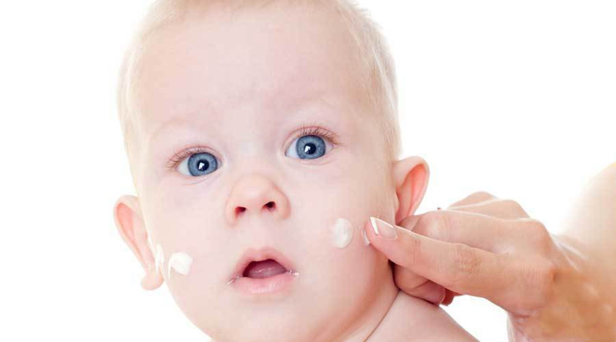 宝宝湿疹治疗过程四大禁忌,宝宝湿疹不要慌治疗湿疹有妙招
