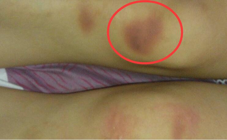 小年龄孩子被打了家长该怎么做,小学生被打了家长正确做法