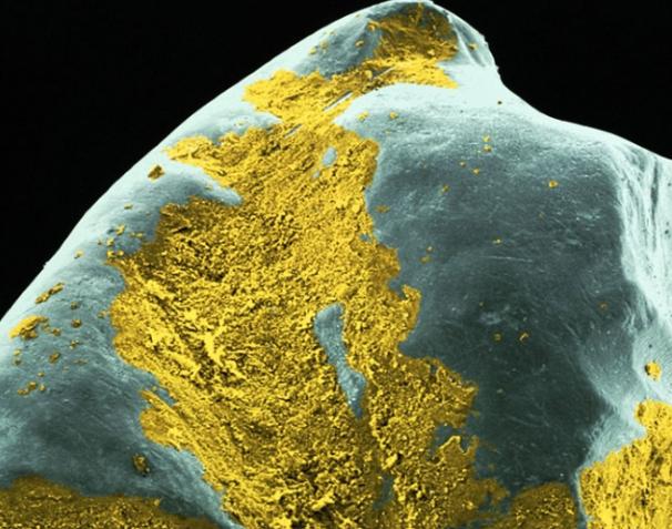 放大两千倍的牙齿表面长什么样？不愧是人体最脏的地方，不堪入目