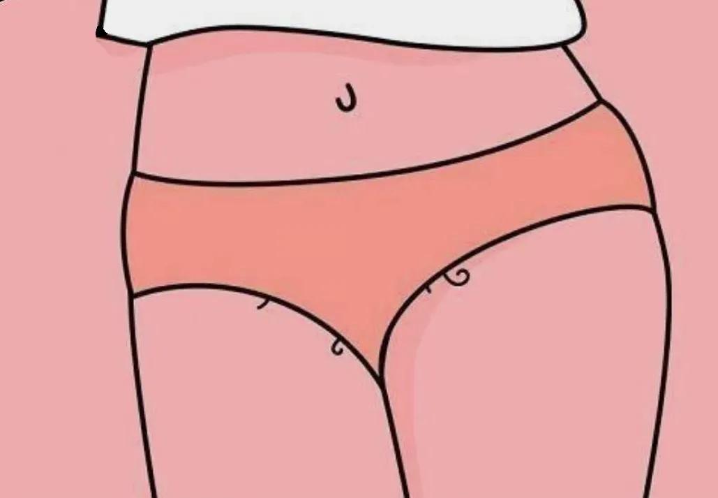 屁屁中间毛太多,也可能是病吗?