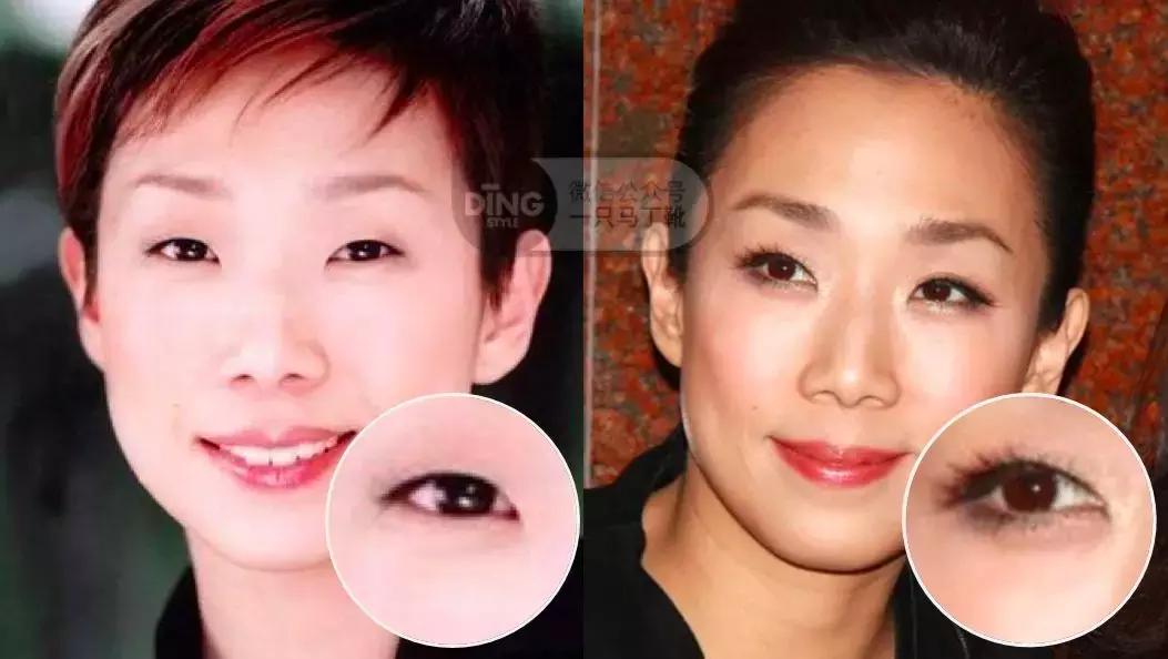 中庭又长又宽显老,中庭长怎么避免显老