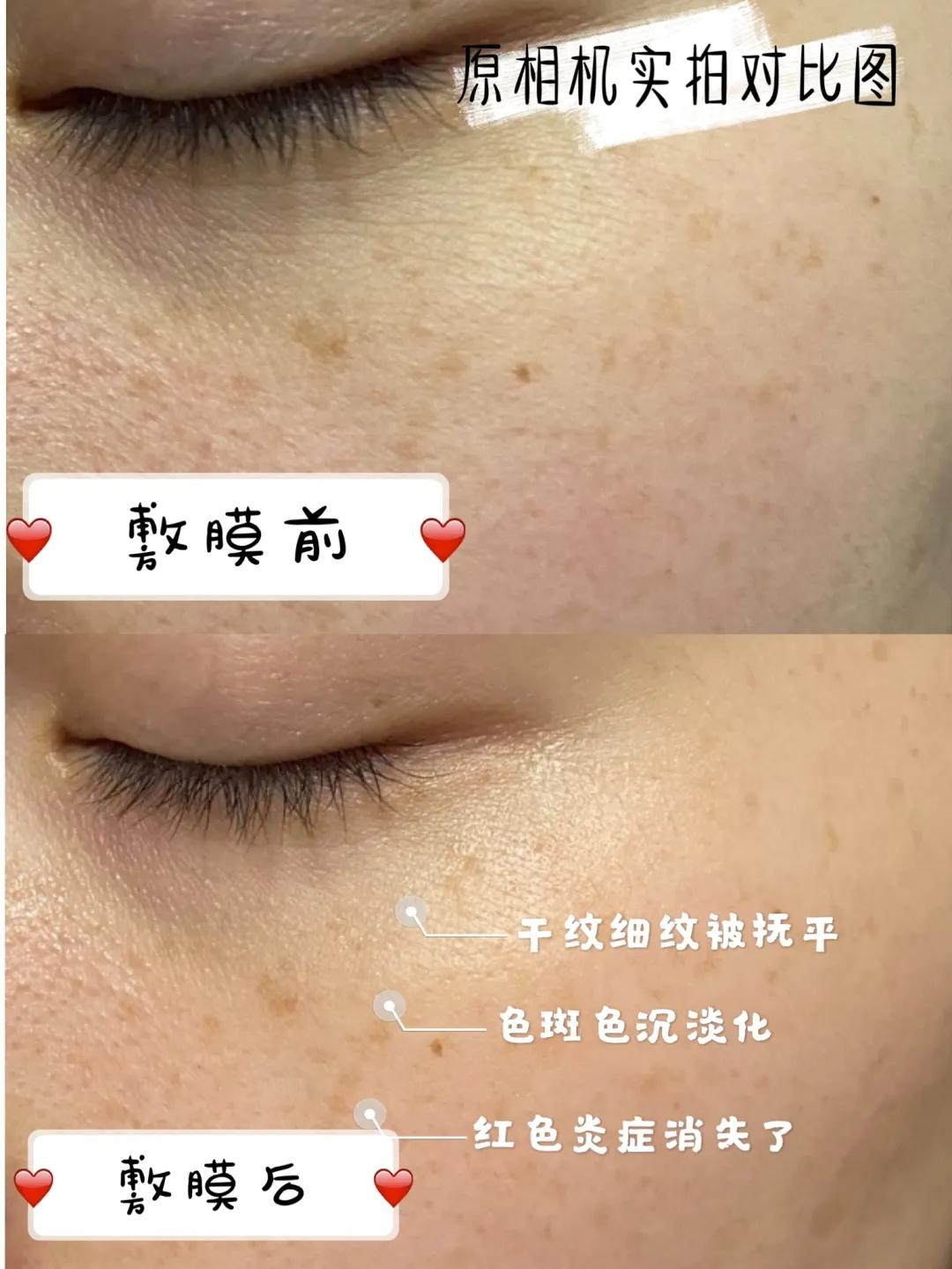 快问快答面膜篇,快问快答护肤问题