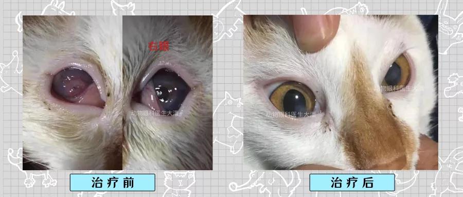 眼角膜溃烂能做角膜移植手术吗,双眼角膜溃疡