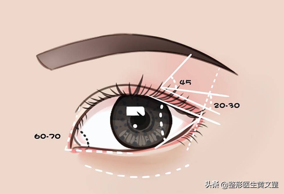 变双眼皮的小妙招学生党,单眼皮变双眼皮的小妙招