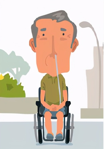 做了胃瘘手术能用嘴吃饭吗,做好这四件事让胃更健康