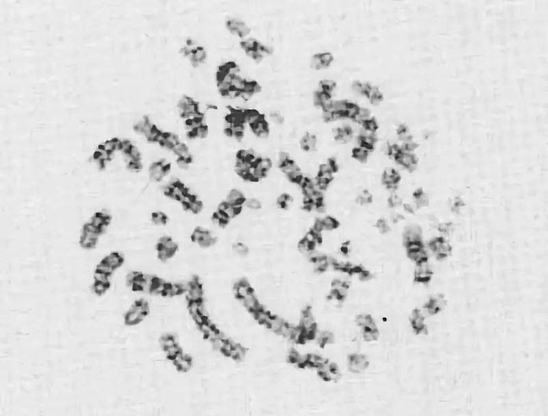 83天痛不欲生的活体腐烂，他在一次核事故后缓慢死去