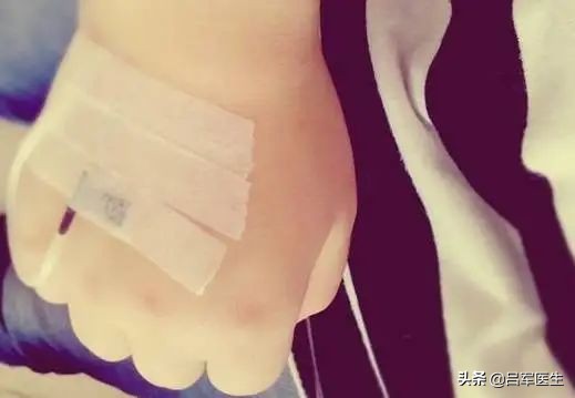 打点滴时空气进入血管会死吗,打点滴把空气打进血管会怎样