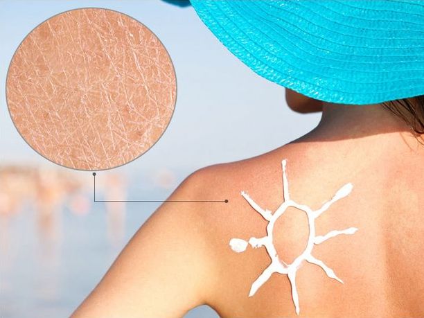 激光修复疤痕皮肤色差,ps如何调整皮肤色差