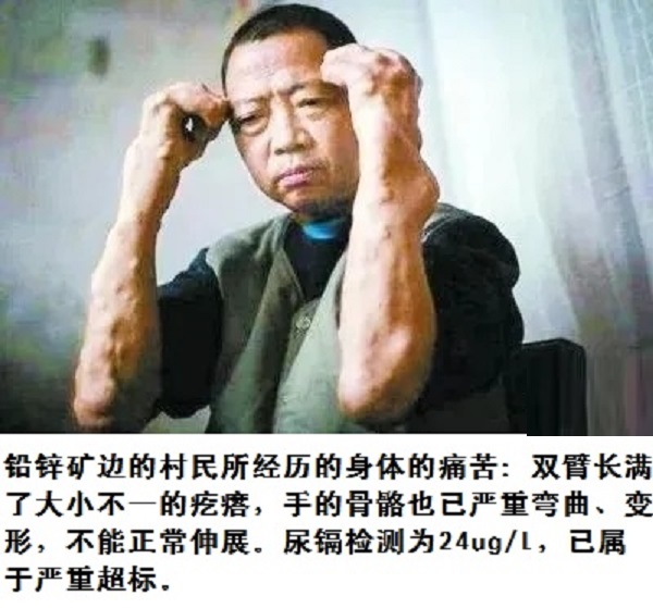 舌尖上的安全感悟,舌尖上的安全全册