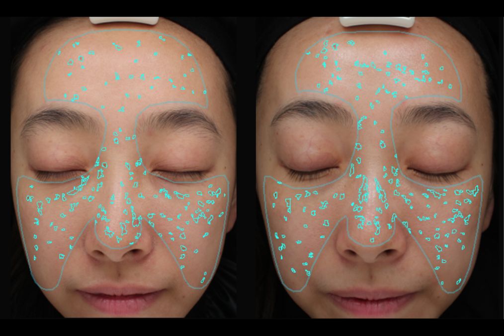 小茂医生美白护肤品,小茂教你如何护肤