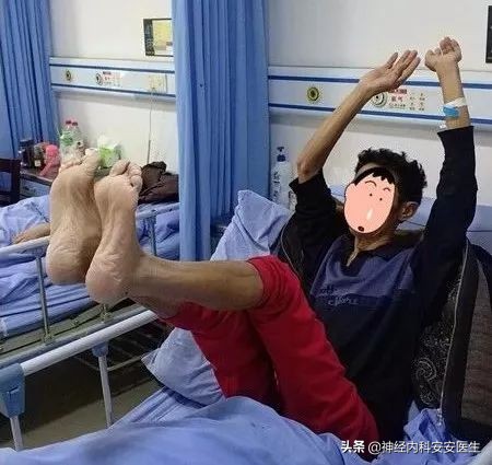 脑梗塞造成的感觉异常有哪些症状,脑梗塞发作是不是浑身无力