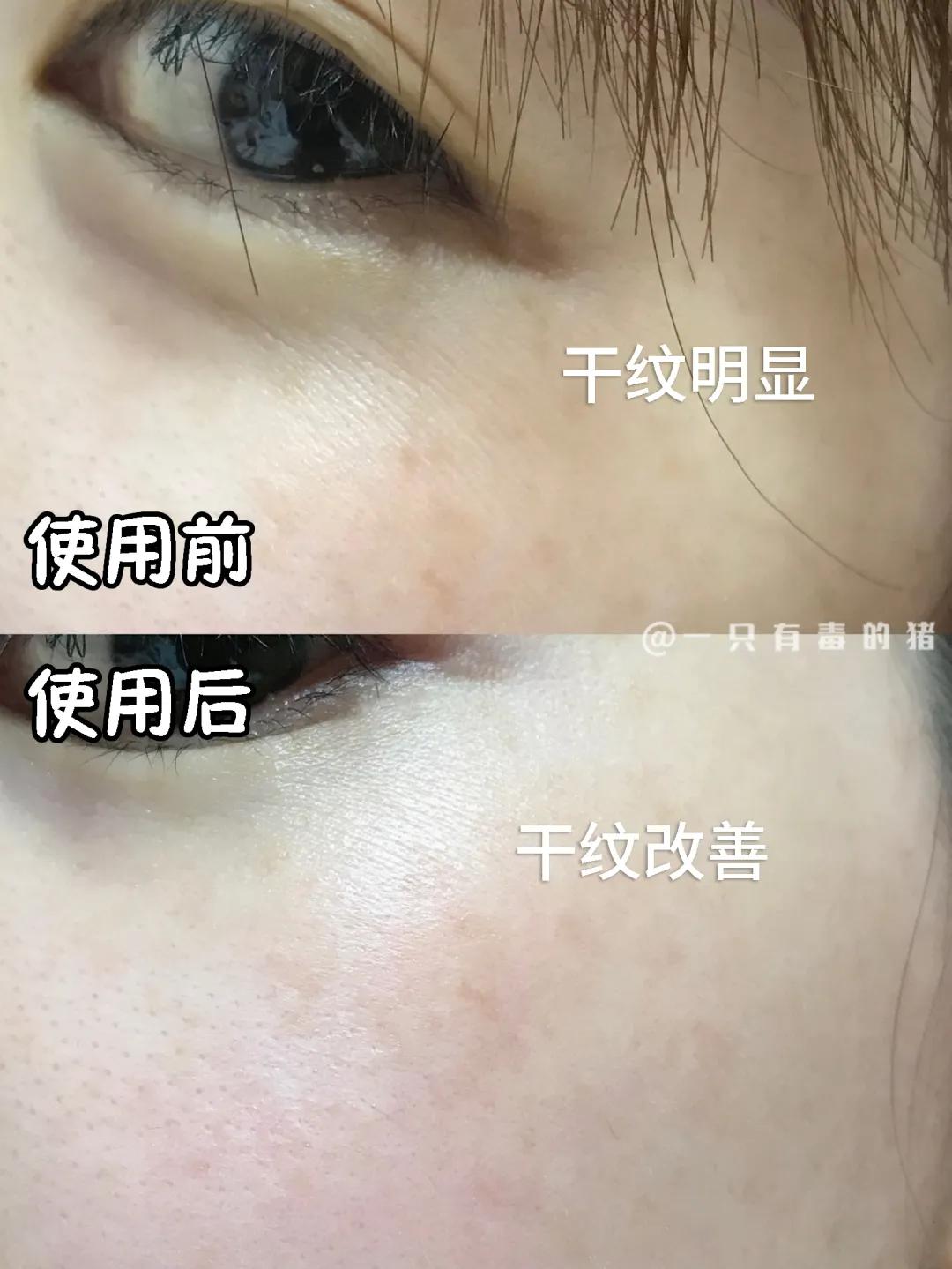 红腰子精华测评三代,第三代红腰子精华测评