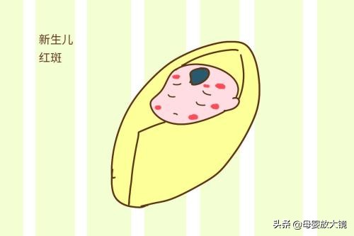 新生宝宝的一些正常现象,天使宝宝的症状有哪些