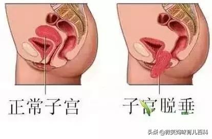 卸货之后肚子痒怎么办,卸货第二天腰疼怎么快速恢复