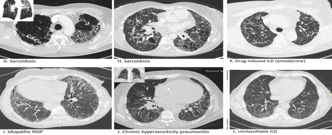 代华平视频,中日友好医院代华平