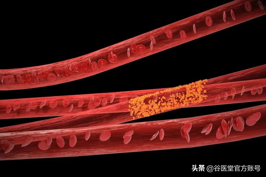 天气冷糖尿病更加重什么原因,寒潮暴雪的危害