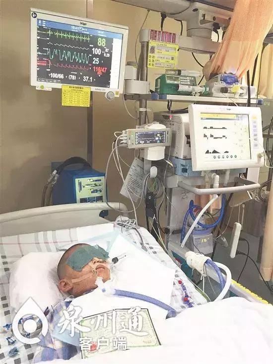 各种各样的毒虫被咬了怎么办,十大毒虫咬了有什么症状