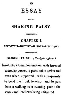 帕金森手部康复治疗,帕金森病能否被完全治愈医学科普