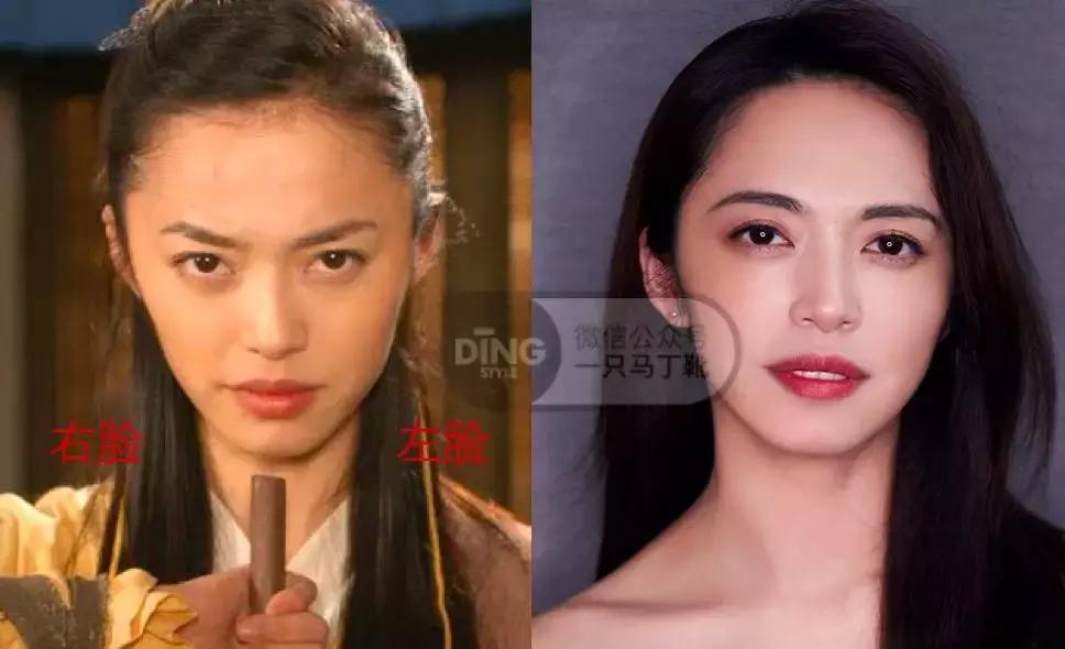 脸大小不对称怎么矫正,如何改善大小脸不对称