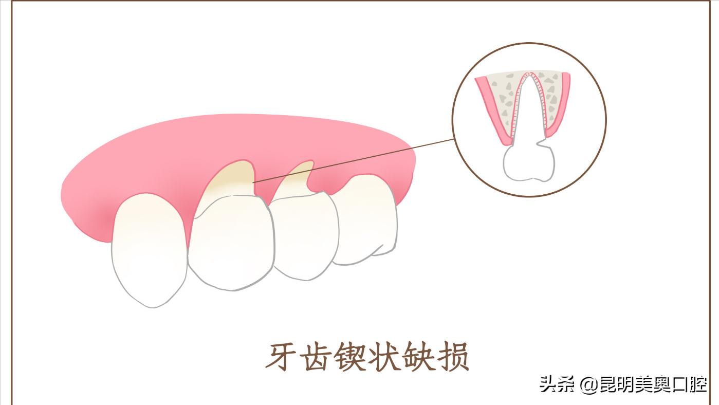 牙痛有哪些症状和治疗方法,引起牙痛的原因以及治疗方法