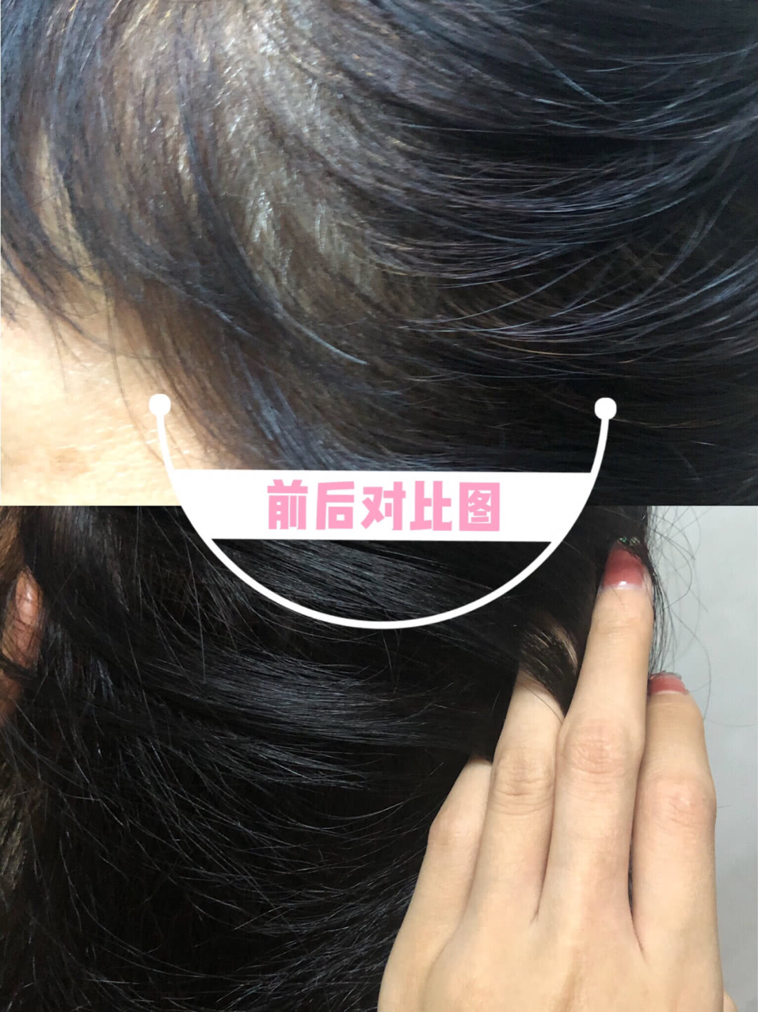 你还在用染发剂吗,你还在用传统染膏盖白发吗