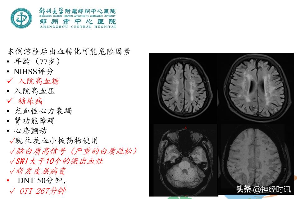 静脉溶栓怎么引起的,静脉相关并发症的预防及处理
