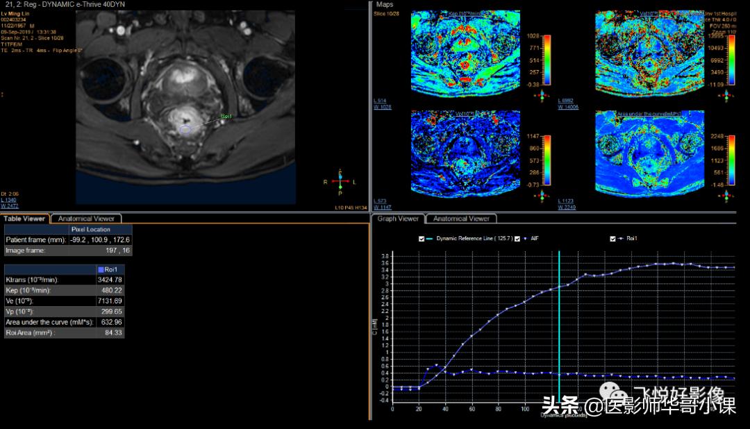 飞利浦磁共振系统界面及操作流程,飞利浦磁共振技术学习