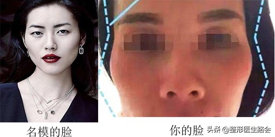 准备做手术应该问医生哪些问题,想做双眼皮先了解术前准备