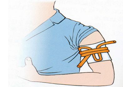 临床中各种出血的急救方法全套攻略