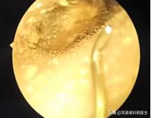 为啥来院就做内镜检查？医生怕是在骗我钱吧