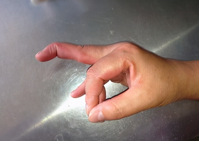 打篮球时手指戳到球了该怎么办,手指被篮球戳了怎么一直疼