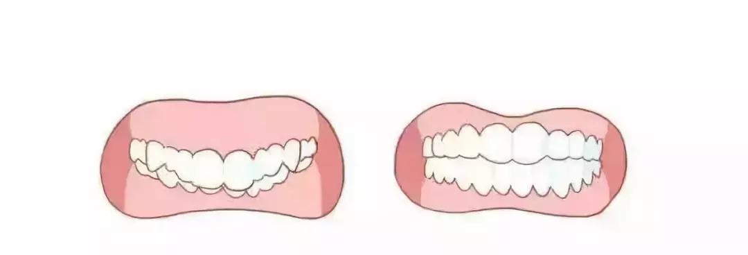 嘴型丑的怎样让嘴唇变得好看,嘴型不好看怎么练才能矫正