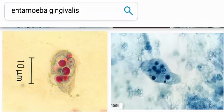 牙根痒痒像塞东西似的怎么回事,牙根痒痒的老想咬东西怎么回事