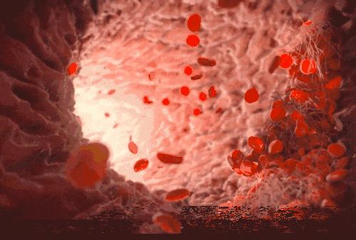 膝关节松解手术后肿是正常的吗,膝关节术后肿胀怎么消