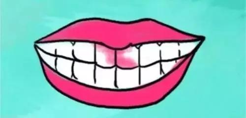 牙套*党**的9个崩溃时刻