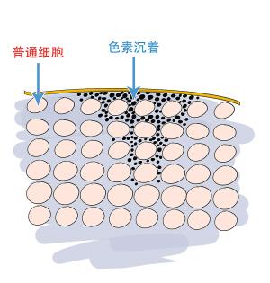 长期对着电脑皮肤怎么护理,对着电脑皮肤会变差吗