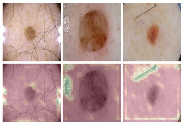 浅谈医学影像学习与实践,基于深度学习的医学影像研究思路