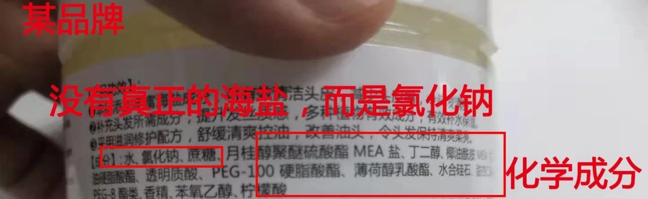 头发易出油头皮多怎么回事,头皮上有螨虫头发掉怎么办