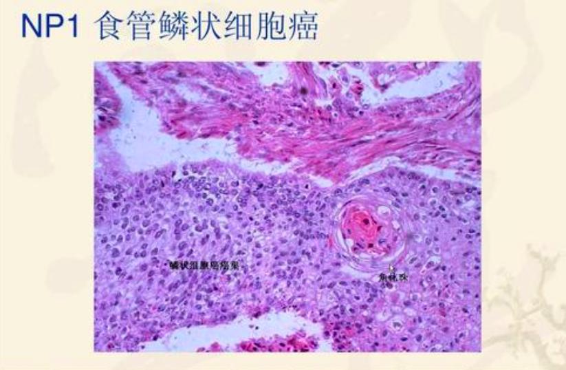 80后科学家预测癌症,两位女性科学家破解了基因锁