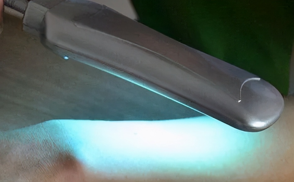 白癜风用308和311哪种激光效果好,白癜风311和308治疗仪有什么区别