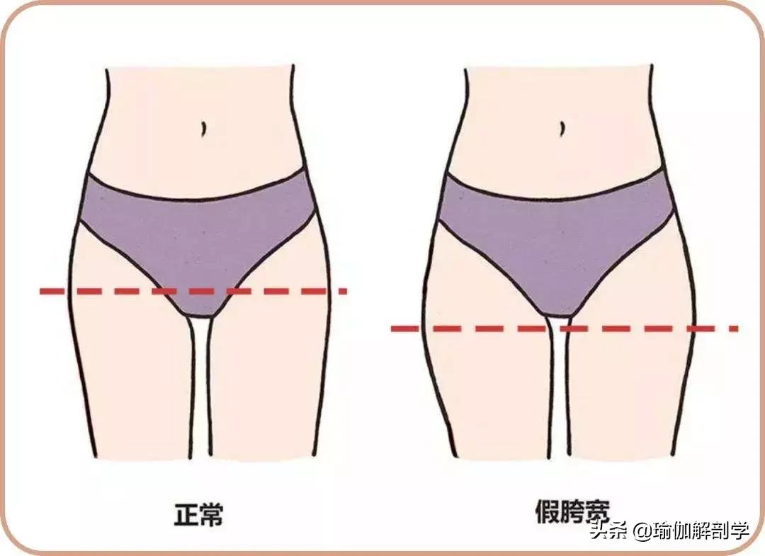 改善假胯宽是练瑜伽还是普拉提,瑜伽怎么练可以瘦胯和大腿