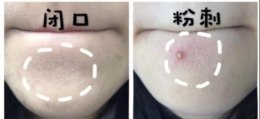 你用的护肤品合法吗,你用的护肤品有效吗