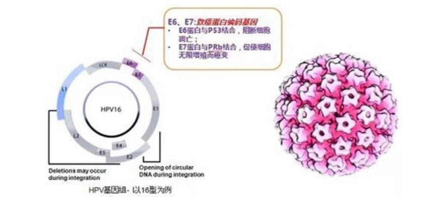 hpv感染临床指南,hpv感染与宫颈炎