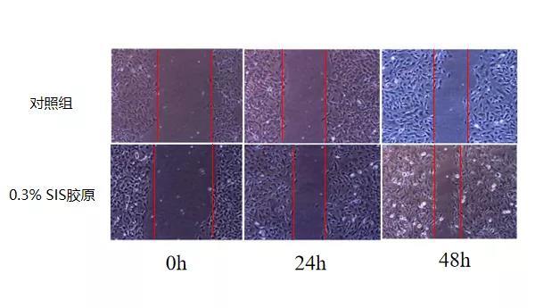 排名第一的胶原蛋白精华,类人胶原蛋白精华推荐
