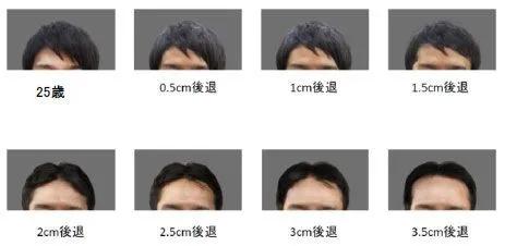 所以秃头的标准是发际线高≥7cm?头秃代表不再是中老年独扛大旗,90后、00后也在积极踊跃加入组织