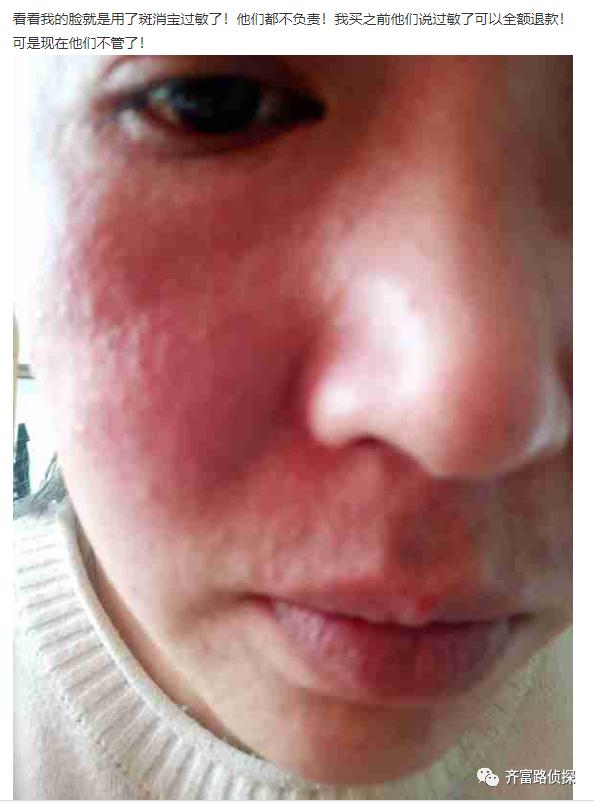 声称有人冒充代理进行诈骗？斑消宝旗下主打产品疑似*牌套**