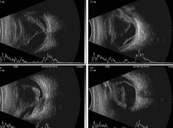 中山眼科中心眼底病专科诊治,大连老年病医院眼科电话号码