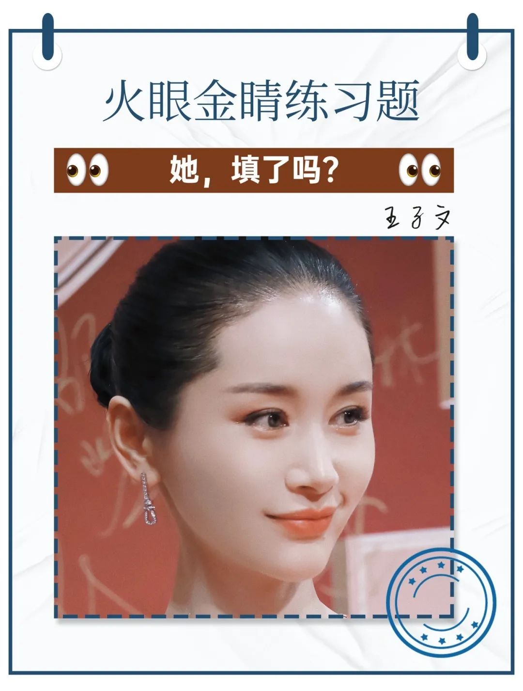 娄艺潇填充脂肪前后对比,娄艺潇填充前后对比